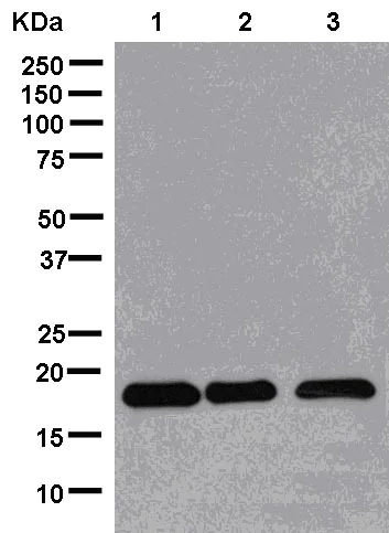 Western blot - Anti-NME3 antibody [EPR13117] (AB181257)