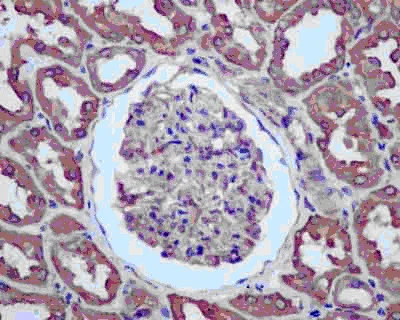 Immunohistochemistry (Formalin/PFA-fixed paraffin-embedded sections) - Anti-NME3 antibody [EPR13117] - BSA and Azide free (AB250470)