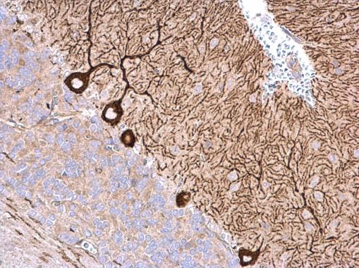 Immunohistochemistry (Formalin/PFA-fixed paraffin-embedded sections) - Anti-NME4 antibody (AB228005)