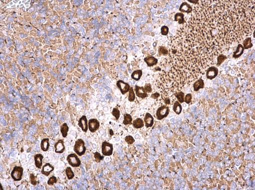 Immunohistochemistry (Formalin/PFA-fixed paraffin-embedded sections) - Anti-NME4 antibody (AB228005)