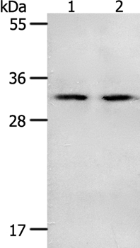 Western blot - Anti-NME6 antibody (AB197686)
