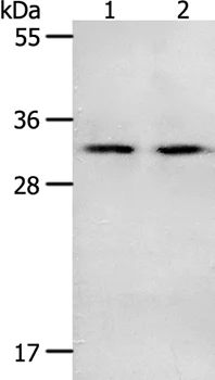 Western blot - Anti-NME6 antibody (AB197686)