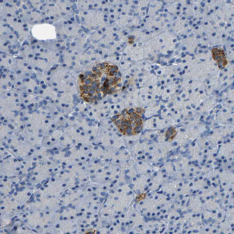 Immunohistochemistry (Formalin/PFA-fixed paraffin-embedded sections) - Anti-NMES1 antibody (AB272562)