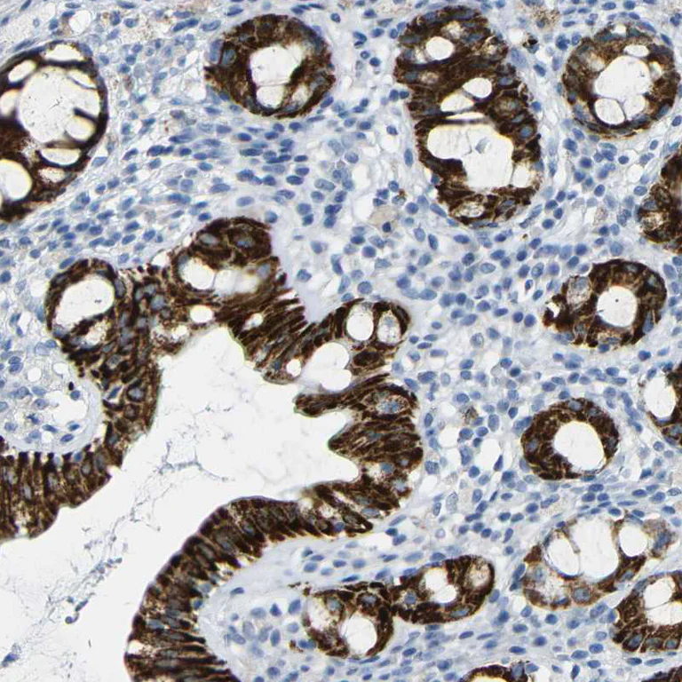 Immunohistochemistry (Formalin/PFA-fixed paraffin-embedded sections) - Anti-NMES1 antibody (AB272562)