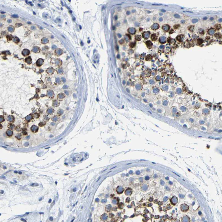 Immunohistochemistry (Formalin/PFA-fixed paraffin-embedded sections) - Anti-NMES1 antibody (AB272562)