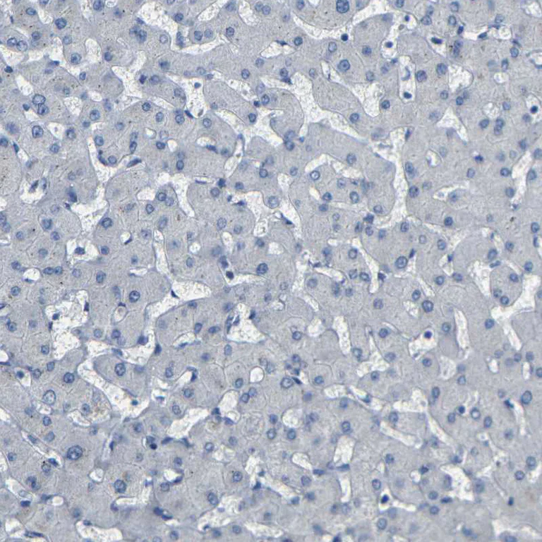 Immunohistochemistry (Formalin/PFA-fixed paraffin-embedded sections) - Anti-NMES1 antibody (AB272562)