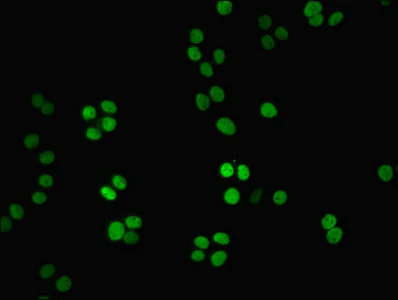 Immunocytochemistry/ Immunofluorescence - Anti-Nmnat1/NMNAT antibody (AB229772)
