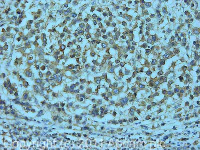 Immunohistochemistry (Formalin/PFA-fixed paraffin-embedded sections) - Anti-NMNAT2 antibody [2E4] (AB56980)