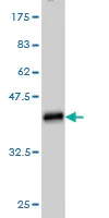 Western blot - Anti-NMNAT2 antibody [2E4] (AB56980)