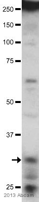 Western blot - Anti-NMNAT2 antibody [2E4] (AB56980)