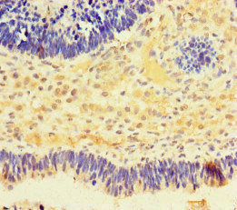 Immunohistochemistry (Formalin/PFA-fixed paraffin-embedded sections) - Anti-NMNAT2 antibody (AB222893)