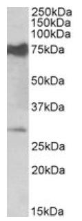 Western blot - Anti-NMNAT3 antibody (AB121030)