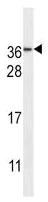 Western blot - Anti-NMNAT3 antibody (AB230839)