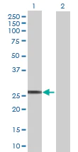Western blot - Anti-NMNAT3 antibody (AB71904)