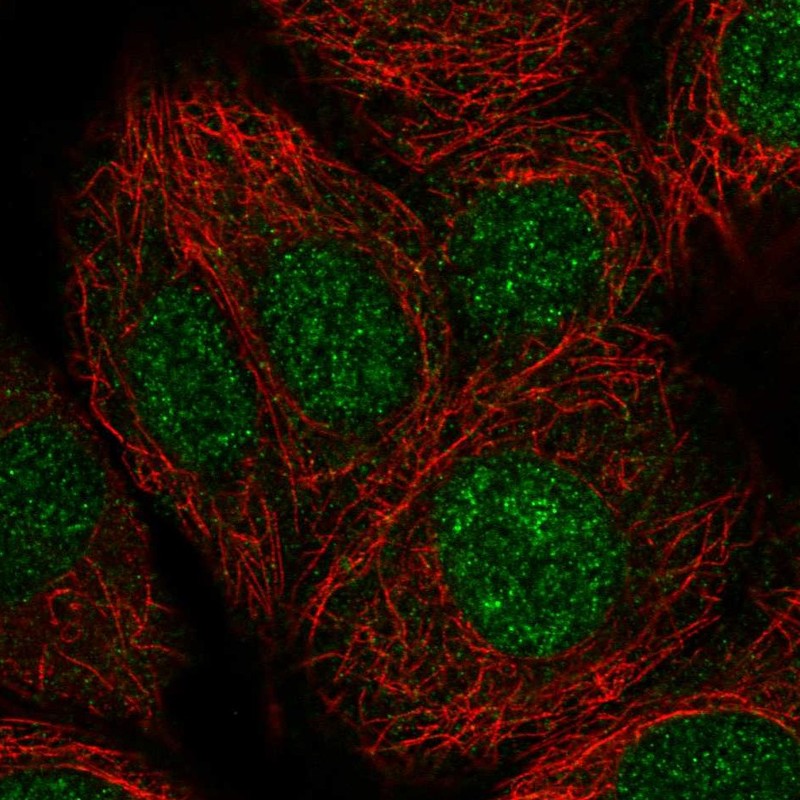 Immunocytochemistry/ Immunofluorescence - Anti-NMRAL1 antibody (AB272637), expandable thumbnail