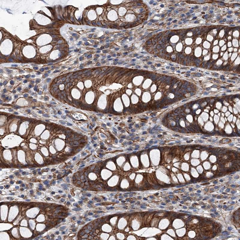 Immunohistochemistry (Formalin/PFA-fixed paraffin-embedded sections) - Anti-NMRAL1 antibody (AB272637), expandable thumbnail