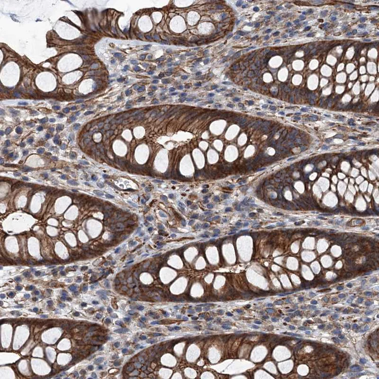 Immunohistochemistry (Formalin/PFA-fixed paraffin-embedded sections) - Anti-NMRAL1 antibody (AB272637)