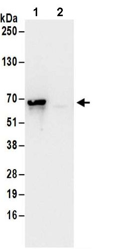 Immunoprecipitation - Anti-NMT1/NMT antibody (AB186123)