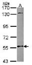 Western blot - Anti-NMT2 antibody (AB102473)