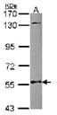 Western blot - Anti-NMT2 antibody (AB102473)