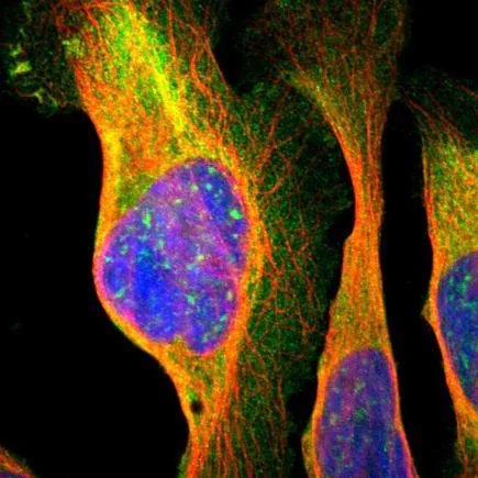 Immunocytochemistry/ Immunofluorescence - Anti-NMT2 antibody (AB224045)