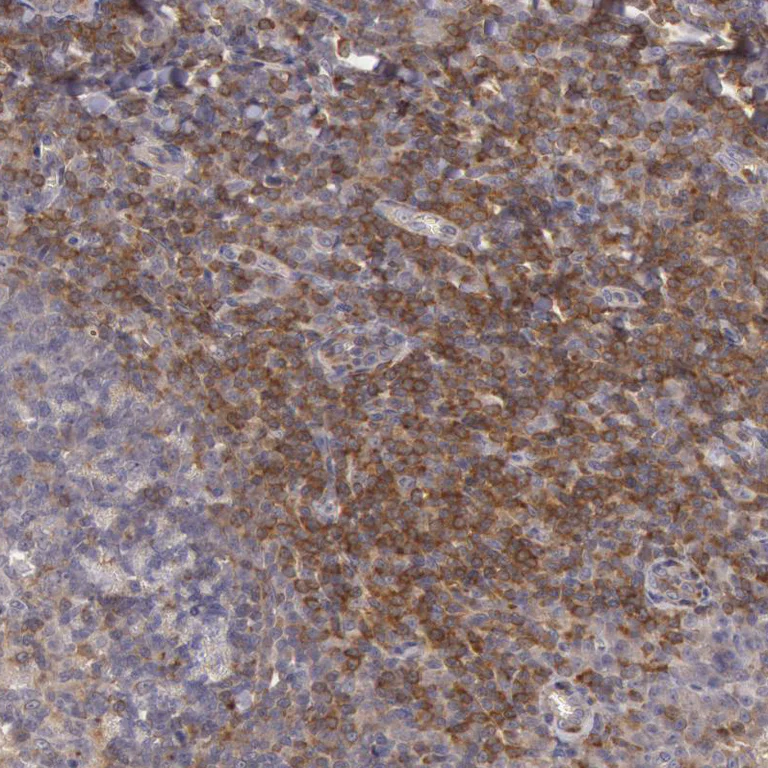 Immunohistochemistry (Formalin/PFA-fixed paraffin-embedded sections) - Anti-NMT2 antibody (AB224045)