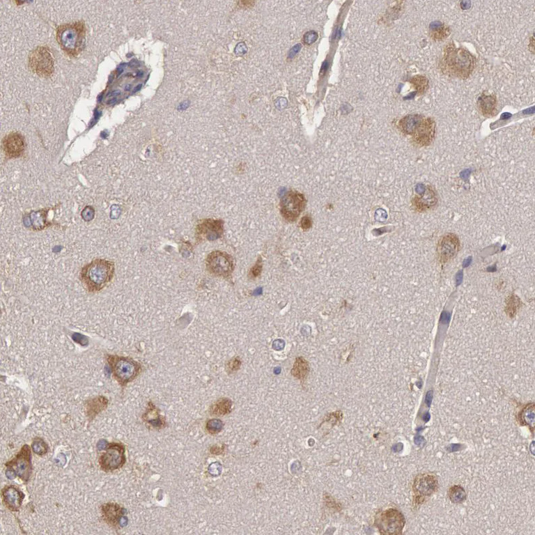 Immunohistochemistry (Formalin/PFA-fixed paraffin-embedded sections) - Anti-NMT2 antibody (AB224045)