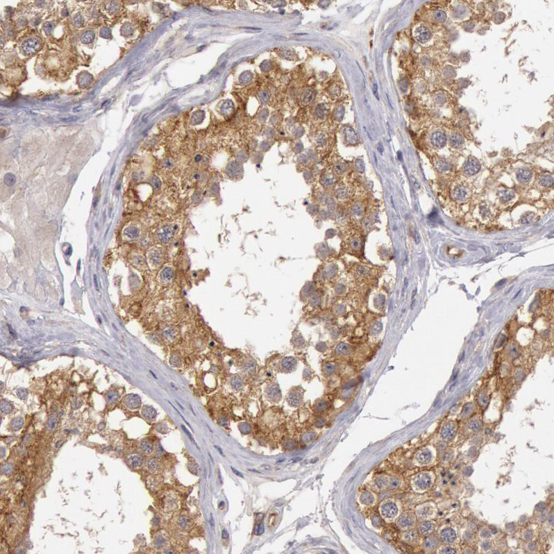 Immunohistochemistry (Formalin/PFA-fixed paraffin-embedded sections) - Anti-NMT2 antibody (AB224045)