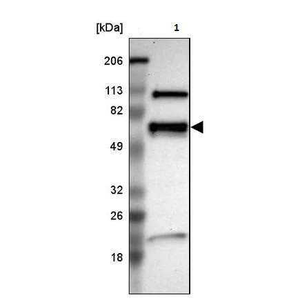 Western blot - Anti-NMT2 antibody (AB224045)