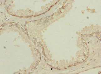 Immunohistochemistry (Formalin/PFA-fixed paraffin-embedded sections) - Anti-NMT2 antibody (AB230028)