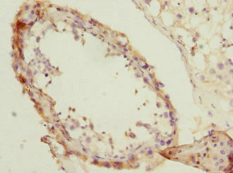 Immunohistochemistry (Formalin/PFA-fixed paraffin-embedded sections) - Anti-NMT2 antibody (AB230028)