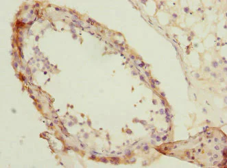 Immunohistochemistry (Formalin/PFA-fixed paraffin-embedded sections) - Anti-NMT2 antibody (AB230028)