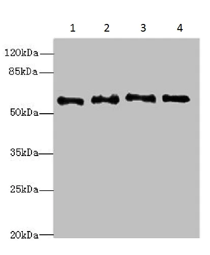 Western blot - Anti-NMT2 antibody (AB230028)