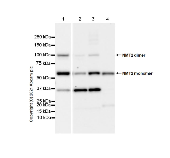 Western blot - Anti-NMT2 antibody [EPR24372-10] (AB270957), expandable thumbnail