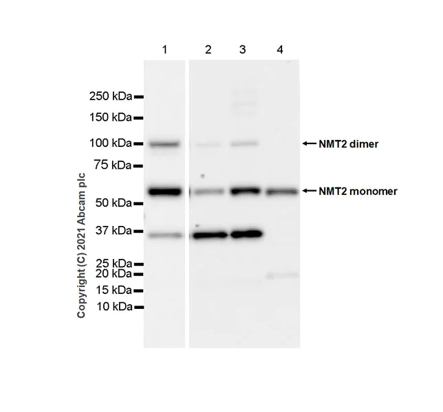 Western blot - Anti-NMT2 antibody [EPR24372-10] (AB270957)