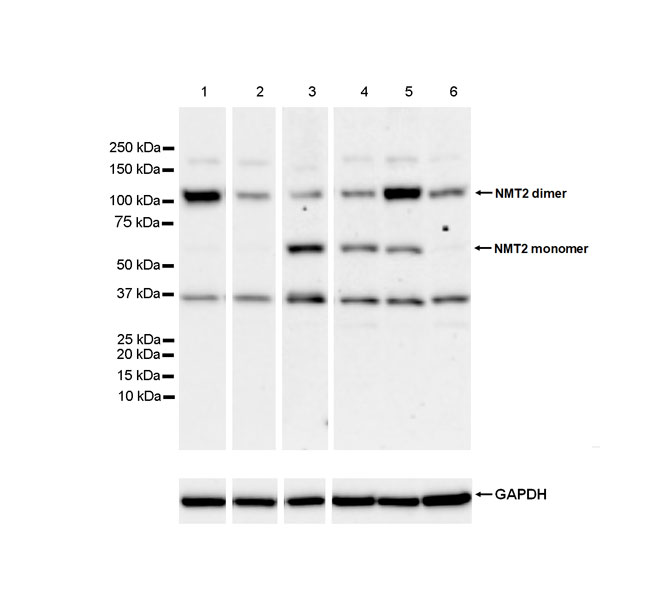 Western blot - Anti-NMT2 antibody [EPR24372-10] (AB270957), expandable thumbnail