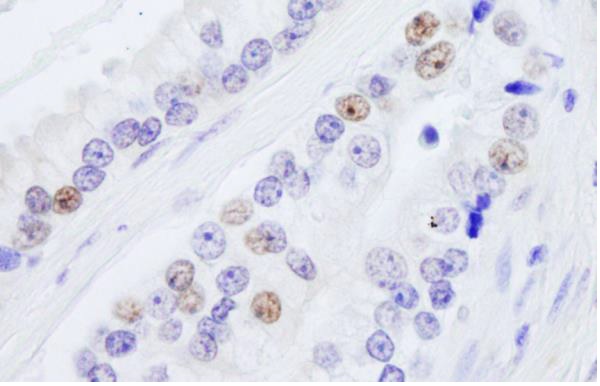 Immunohistochemistry (Formalin/PFA-fixed paraffin-embedded sections) - Anti-nmt55 / p54nrb antibody (AB245464)