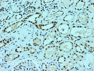 Immunohistochemistry (Formalin/PFA-fixed paraffin-embedded sections) - Anti-nmt55 / p54nrb antibody (AB70335)