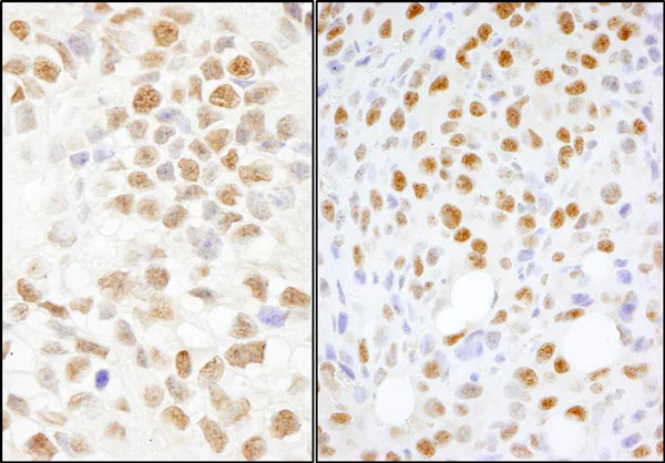ma5ページ Anti-DFNA5/GSDME antibody - N-terminal [EPR19859] (ab215191