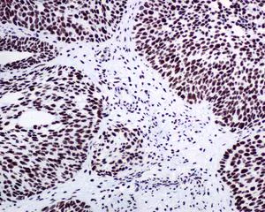 Immunohistochemistry (Formalin/PFA-fixed paraffin-embedded sections) - Anti-nmt55 / p54nrb antibody [EPR5270] (AB133574)