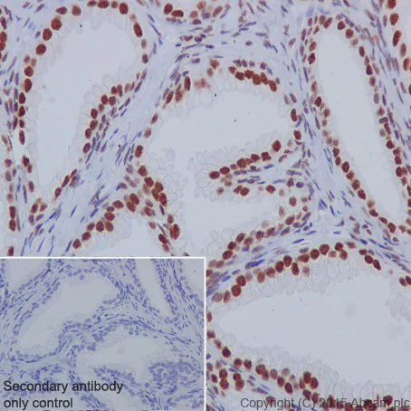 Immunohistochemistry (Formalin/PFA-fixed paraffin-embedded sections) - Anti-nmt55 / p54nrb antibody [EPR5270] - BSA and Azide free (AB226140)