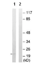Western blot - Anti-NMU antibody (AB92693)