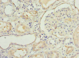 Immunohistochemistry (Formalin/PFA-fixed paraffin-embedded sections) - Anti-NNMT antibody (AB223513)