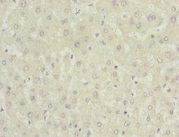 Immunohistochemistry (Formalin/PFA-fixed paraffin-embedded sections) - Anti-NNMT antibody (AB223513)
