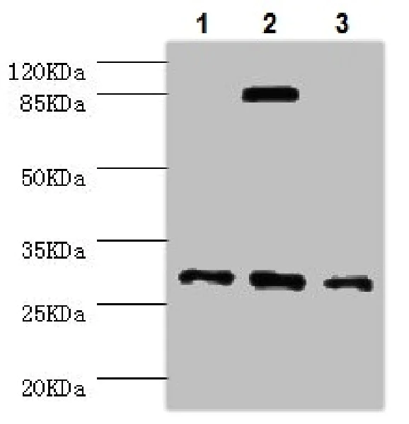 Western blot - Anti-NNMT antibody (AB223513)