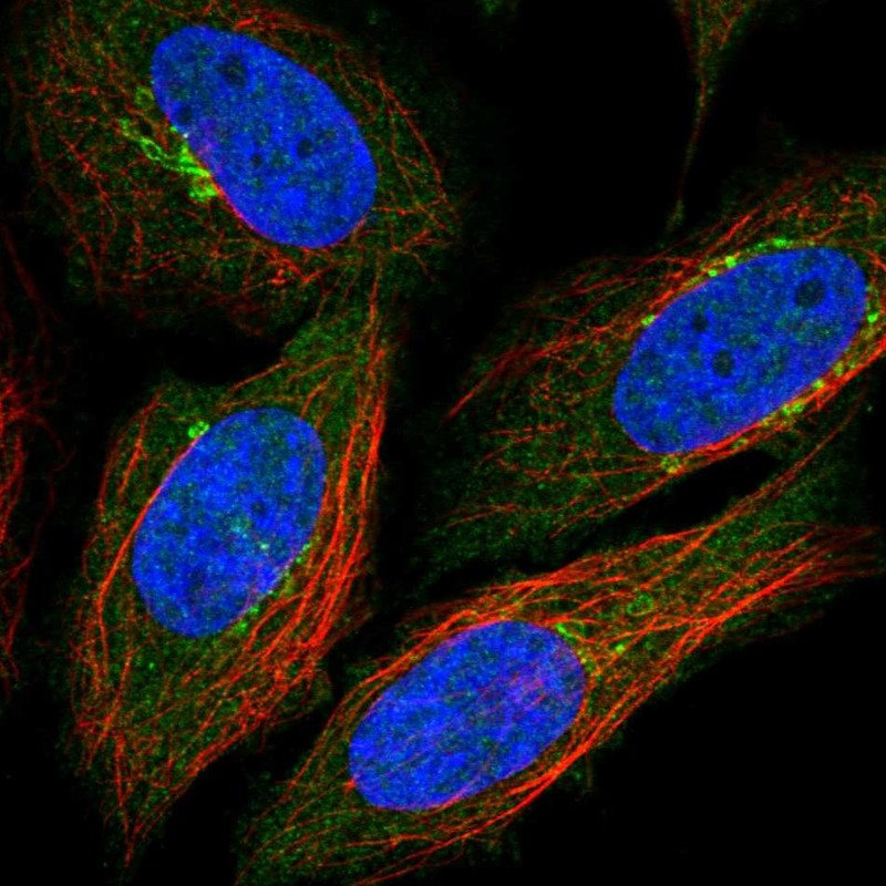 Immunocytochemistry/ Immunofluorescence - Anti-NNMT antibody (AB272669), expandable thumbnail