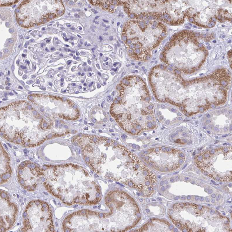 Immunohistochemistry (Formalin/PFA-fixed paraffin-embedded sections) - Anti-NNMT antibody (AB272669), expandable thumbnail