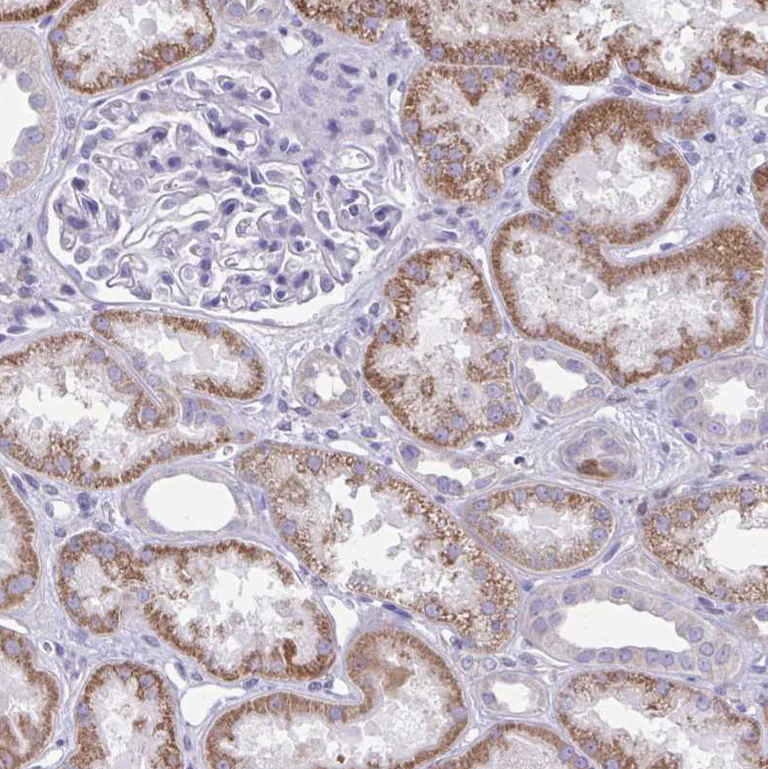 Immunohistochemistry (Formalin/PFA-fixed paraffin-embedded sections) - Anti-NNMT antibody (AB272669)