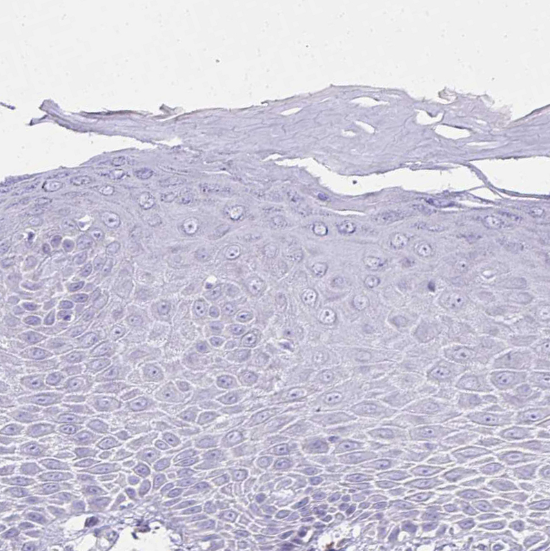 Immunohistochemistry (Formalin/PFA-fixed paraffin-embedded sections) - Anti-NNMT antibody (ab272669), expandable thumbnail
