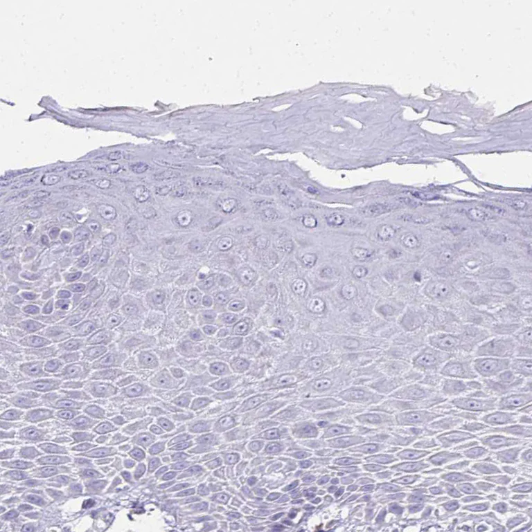 Immunohistochemistry (Formalin/PFA-fixed paraffin-embedded sections) - Anti-NNMT antibody (AB272669)